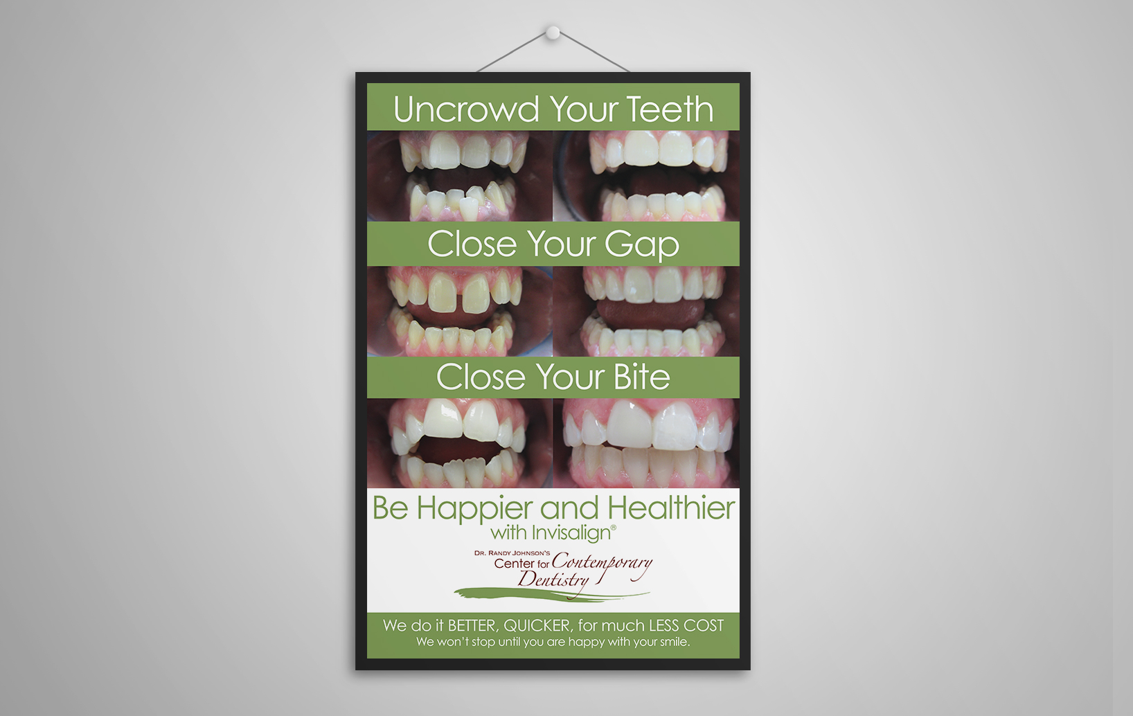 image of invisalign® Poster